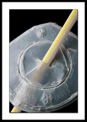 Lid