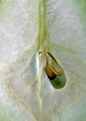 Pear's kripsorchia