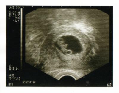 Baby2 (8wks).JPG