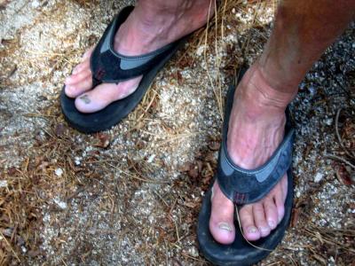 Art's badly blistered feet (Marshall said Art did not complain even once on the trail!)