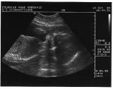UltraSound001.jpg