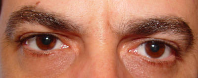 STF Eyes - YouWish