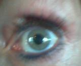 ....signs of intelligent life?  (my eye from cell phone camera)