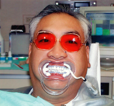 I never heard of teeth whitening before.  My son-in-law scared me the first time he showed me this picture of him!