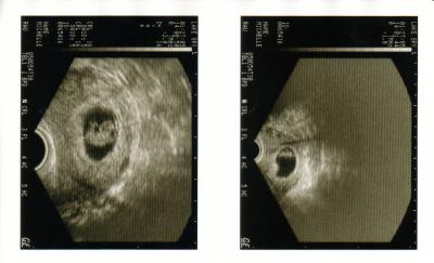 Baby(8wks).JPG