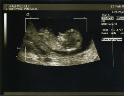 Baby1 (12wks).jpg