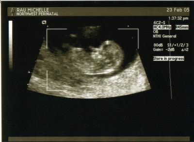 Baby2 (12wks).jpg