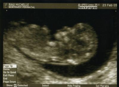 Baby4 (12wks).jpg