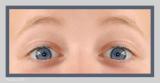 <p align=center><b>Anatomy Of Surprise</b><br><font size=1>by Markjay</font></p>