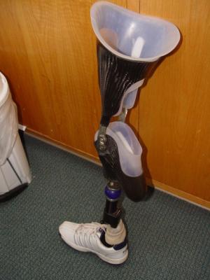 James's lucky leg