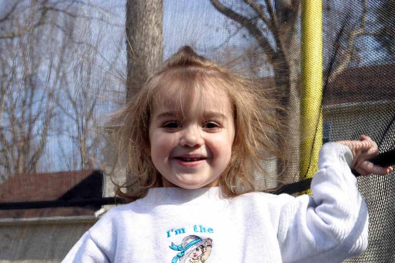 Electric hair!!