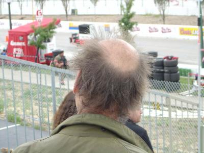 Hair Today, Gone Tomorrow....