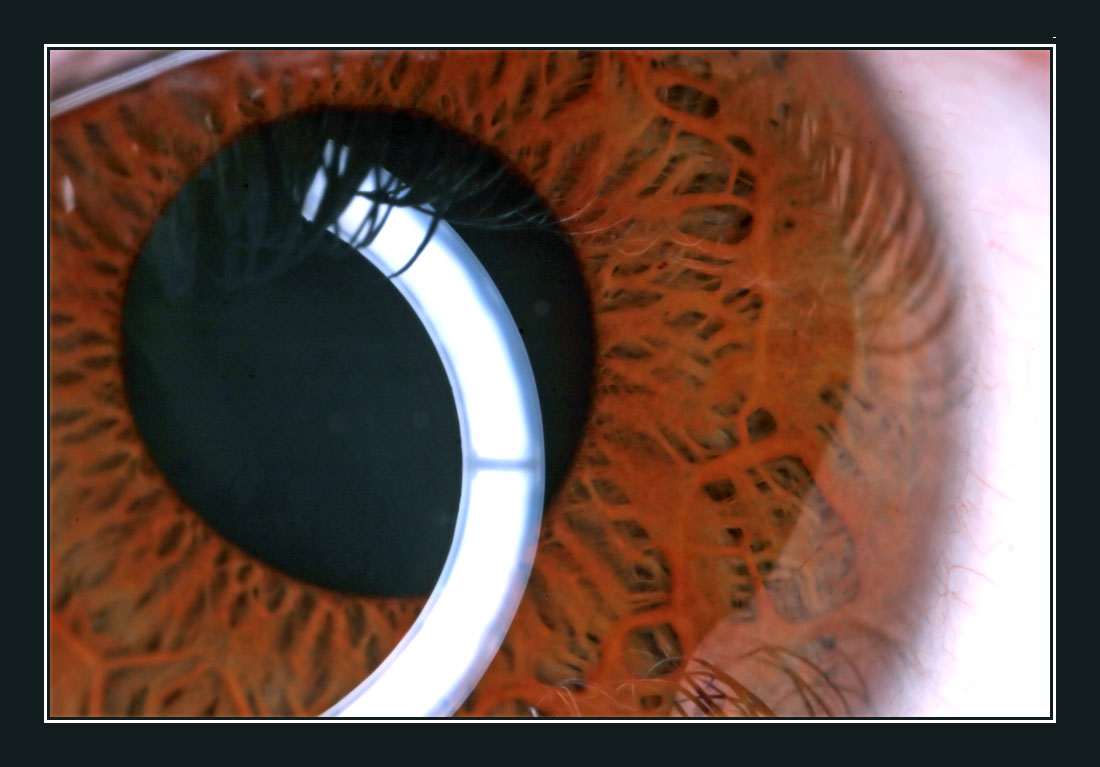 <b>:: Eye Catching ::</b><br>by Jon M