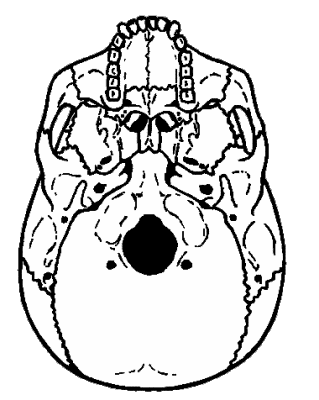 Skull (base)
