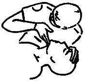CPR illustration (opening airway)
