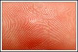 <B>Pattern of Identity *</B>