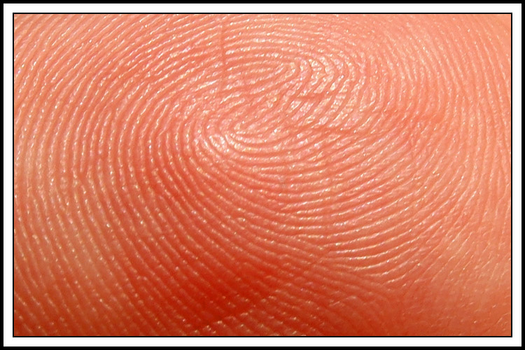 <B>Pattern of Identity *</B>