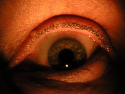 Eyelights-Original by Tom