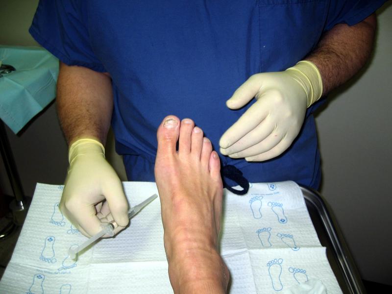 I HATE the needles!