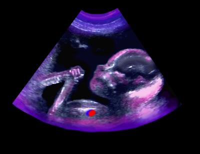 u43/sonoart/medium/34300349.UntitledDuplicated03.jpg