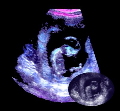 Baby Waiting