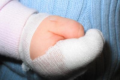 bad finger