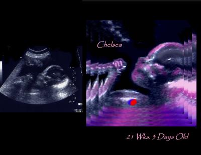 u44/sonoart/medium/34353128.chelsbeforafter4gall.jpg