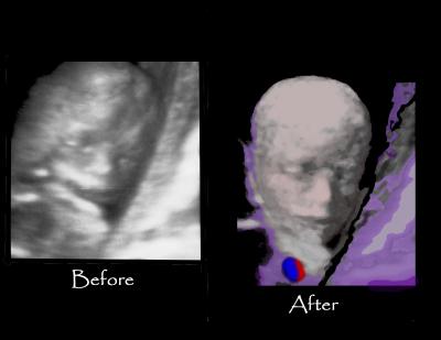 u44/sonoart/medium/34354028.beforeafterscrb4gall.jpg