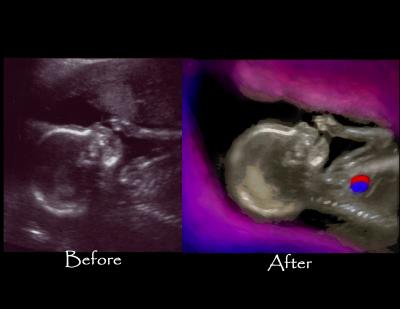 u44/sonoart/medium/34354419.beforeafterscrib2d.jpg