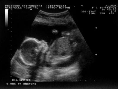 135 Its A Wee Girlie.