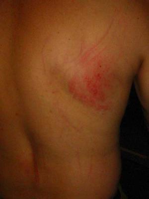 rasberry-on-back.jpg