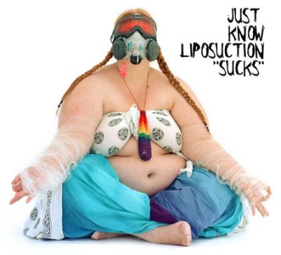 Liposuction sucks.jpg
