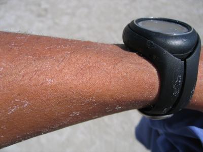 Salt deposits on my arm