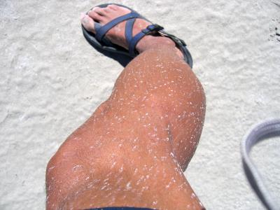 Salt deposits cover my leg
