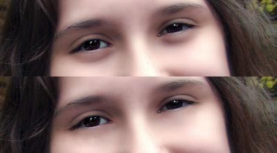 Lightening under eyes,
 before and after