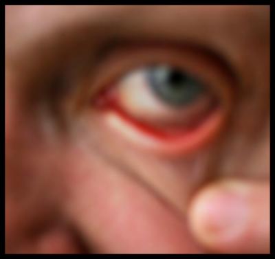 Eye