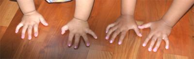 Lauren's Hands (left) and Anna's Hands (right), pretty in pink