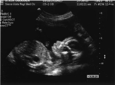 ultrasound2.jpg