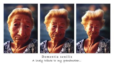 Dementia senilis