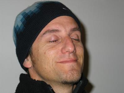 Greg after those crazy eye drops