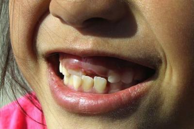 18060-Molly's Teeth.JPG