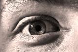 Eye