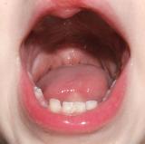 Bottom Teeth