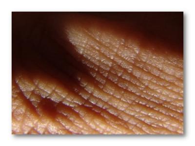 Aurulentus Epidermisby Jeff D