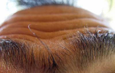 Observing the last hair i'm  going to loseby Joe Bonello