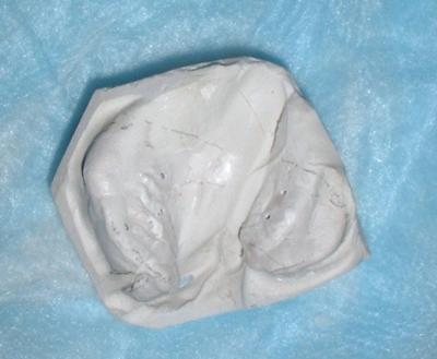 2 INFANT MOLD