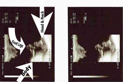 Fawkes Ultrasound @ 65 days