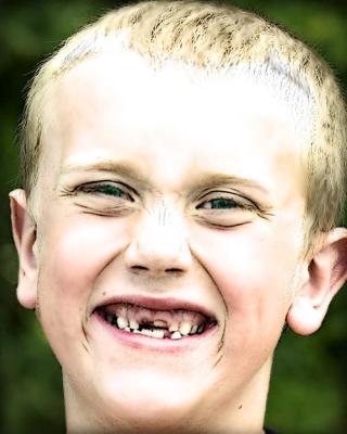 v3/08/54808/3/44792603.3TeethGone8222.jpg