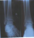 Gordy's Right Foot