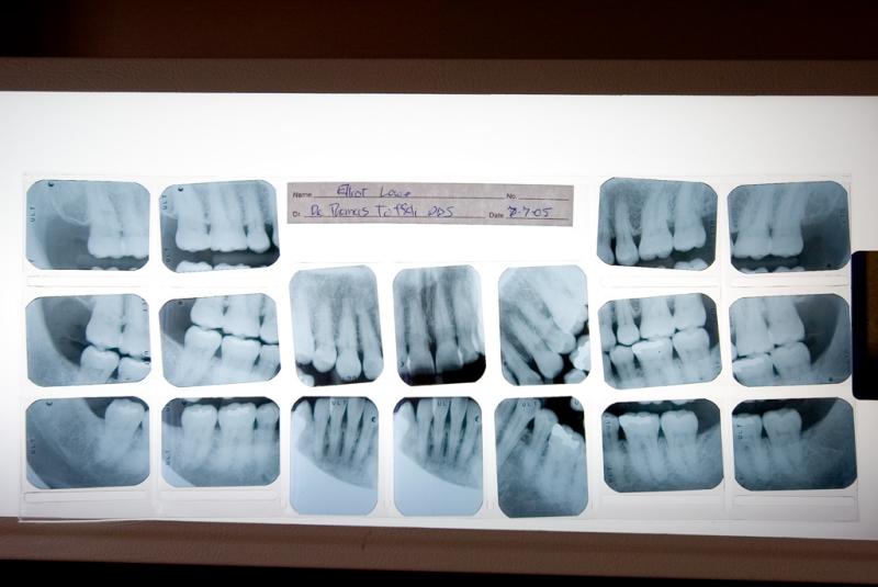 7/7/2005  My dental X-ray 